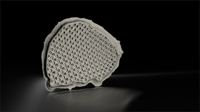 Autodesk, 3D baskı ortopedik implantlarda sınırları zorluyor