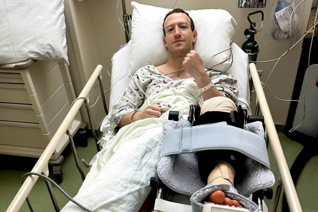 Mark Zuckerberg kafes dövüşüne girmeden sakatlandı!
