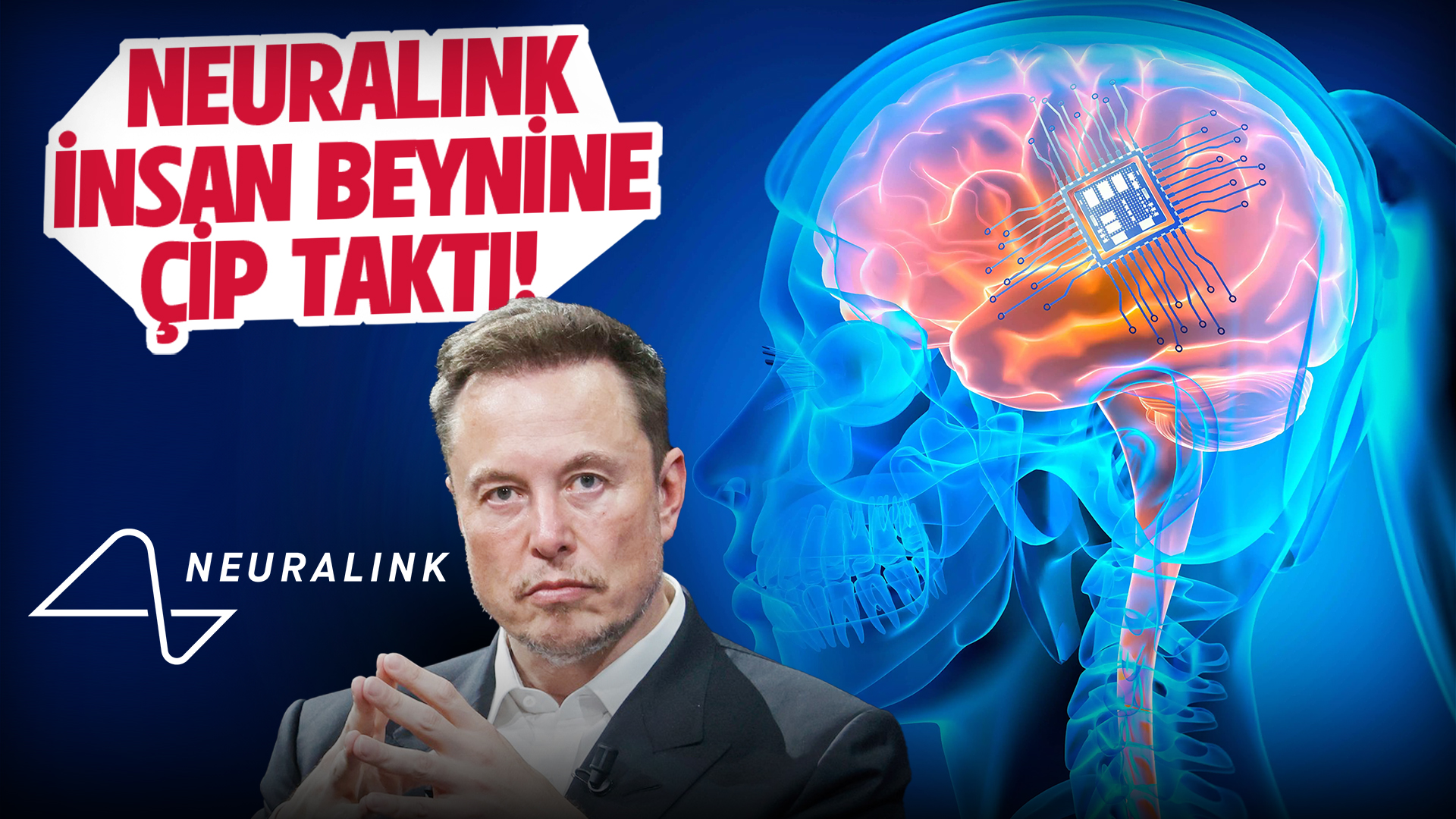 Elon Musk, Neuralink ile neyi hedefliyor ve çalışmalar ne durumda?