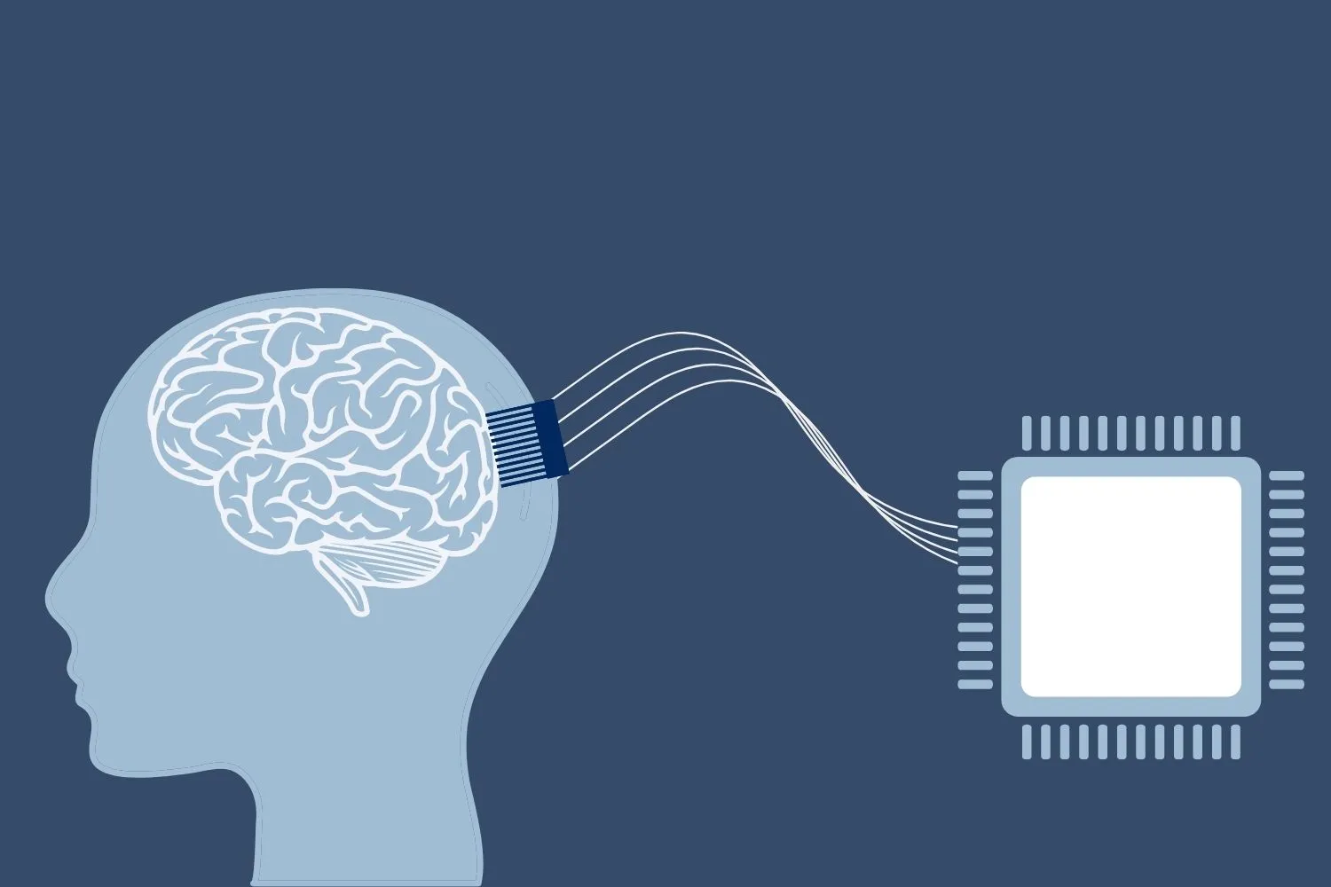 Beyin implantı testleri sorunlarla gündemde