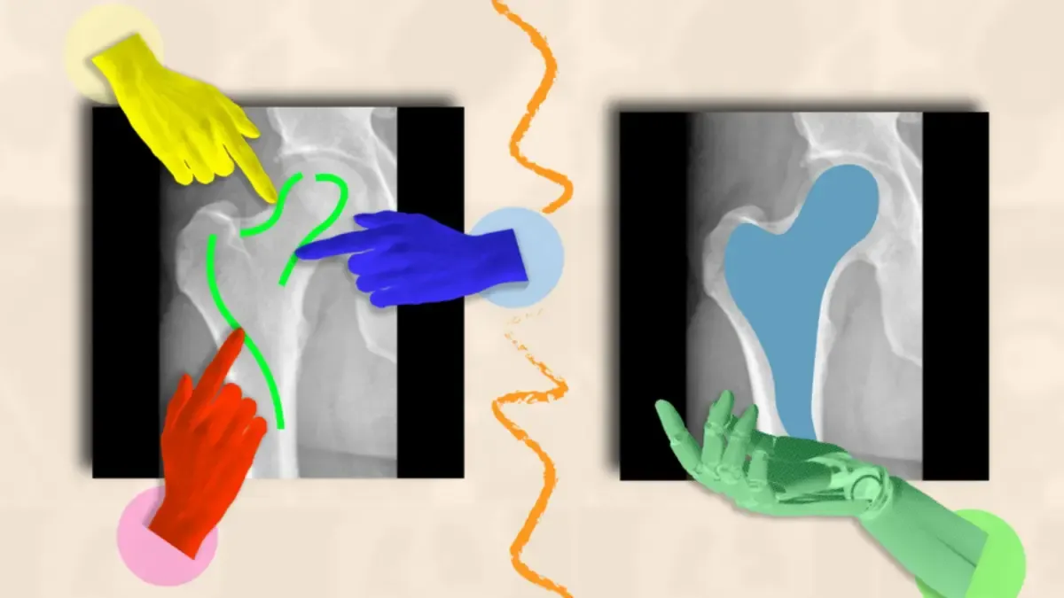 Yapay zeka tıbbi görüntülemede hızı artırıyor