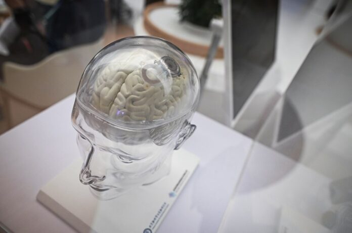 Yapay zekalı beyin implantları